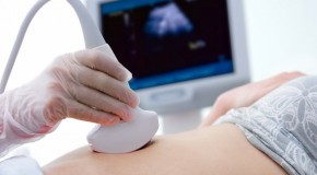 ultrazvuk trudnice
