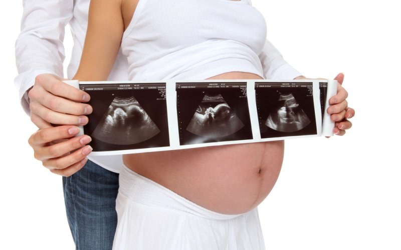 trudnica i slike s ultrazvuka